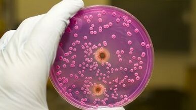 Pathological discharge in men when excited